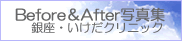 Before&After�ʐ^�W