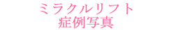 �~���N�����t�g�Ǘ�ʐ^