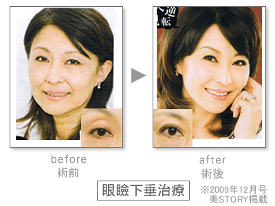 ���ى����@Before&After
