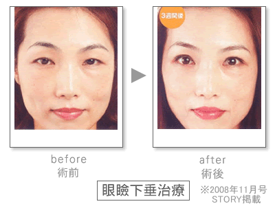 ���ى����@Before&After