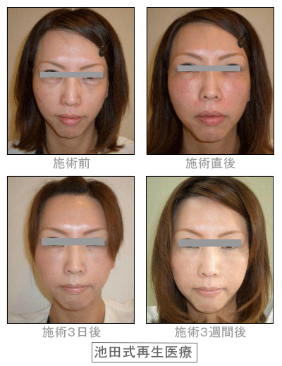 �Đ���Á@Before&After