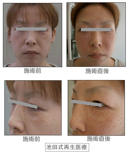 �Đ���Á@Before&After