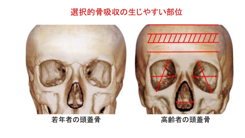 顔のアンチエイジング