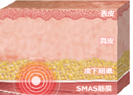 SMAS筋膜に働きかける