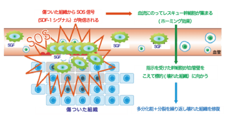 歯髄幹細胞培養上清液の点滴による