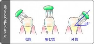 歯磨きの方法について