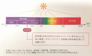 Jトラック　ナローバンドUVB療法